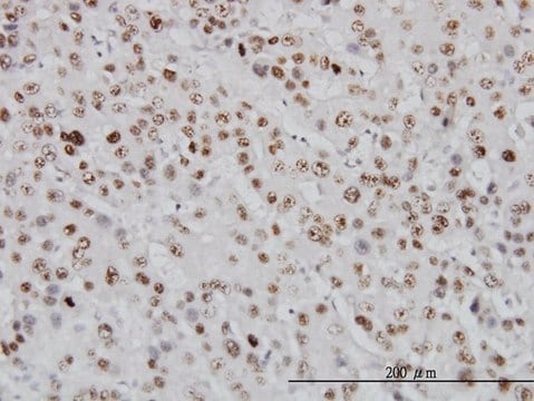 Monoclonal Anti-TOP1 antibody produced in mouse clone 1A1, purified immunoglobulin, buffered aqueous solution