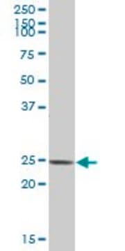 Anti-ARHGDIB antibody produced in mouse purified immunoglobulin, buffered aqueous solution