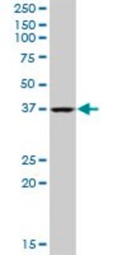 Anti-QTRT1 antibody produced in mouse purified immunoglobulin, buffered aqueous solution