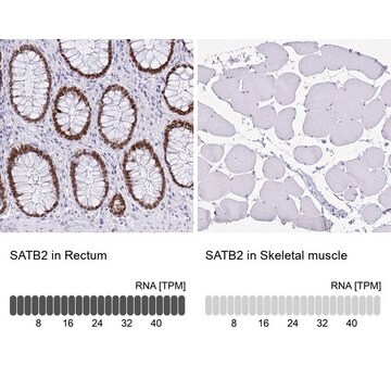 Monoclonal Anti-SATB2 antibody produced in mouse Prestige Antibodies&#174; Powered by Atlas Antibodies, clone CL0276, purified immunoglobulin, buffered aqueous glycerol solution