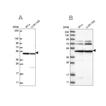 Anti-HADHB antibody produced in rabbit Prestige Antibodies&#174; Powered by Atlas Antibodies, affinity isolated antibody