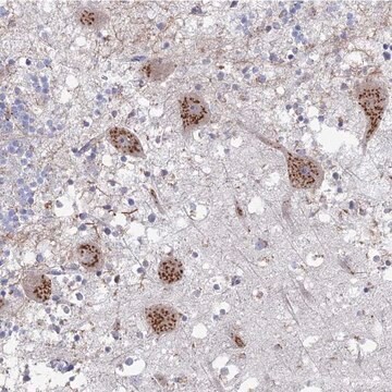 Anti-PITX3 antibody produced in rabbit Prestige Antibodies&#174; Powered by Atlas Antibodies, affinity isolated antibody, buffered aqueous glycerol solution