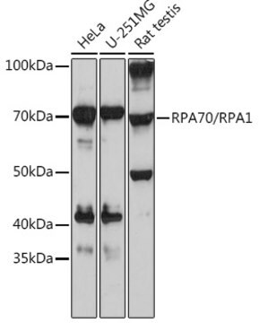 Anti-RPA70/RPA1 Antibody, clone 5R7S3, Rabbit Monoclonal