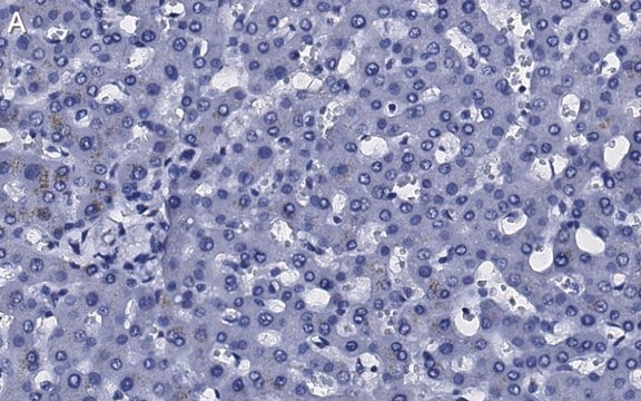 Anti-Transferrin Antibody, clone 2B8 , ZooMAb&#174; Rabbit Monoclonal recombinant, expressed in HEK 293 cells