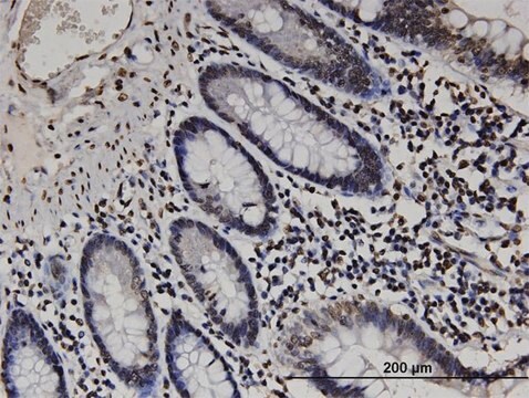 Monoclonal Anti-RABGAP1L antibody produced in mouse clone 2D3, purified immunoglobulin, buffered aqueous solution