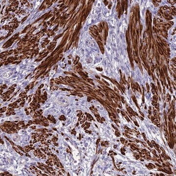 Anti-CLIP4 antibody produced in rabbit Prestige Antibodies&#174; Powered by Atlas Antibodies, affinity isolated antibody, buffered aqueous glycerol solution