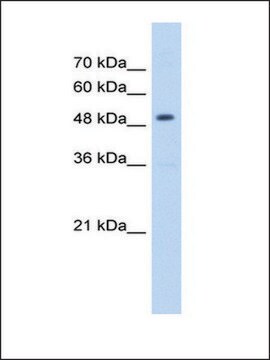 Anti-HMGCS2 (AB1) antibody produced in rabbit IgG fraction of antiserum, lyophilized powder