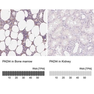 Anti-PADI4 antibody produced in rabbit Prestige Antibodies&#174; Powered by Atlas Antibodies, affinity isolated antibody, buffered aqueous glycerol solution