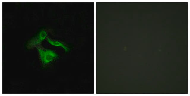 Anti-GPR149 antibody produced in rabbit affinity isolated antibody