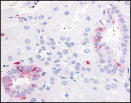 Anti-PTGER2 (AB1) antibody produced in rabbit affinity isolated antibody, buffered aqueous solution