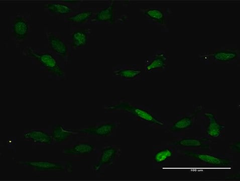 Anti-NFAT5 antibody produced in mouse purified immunoglobulin, buffered aqueous solution