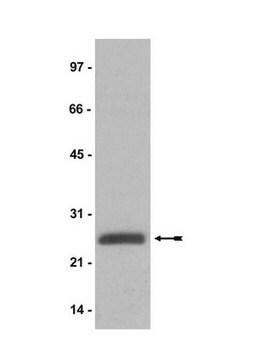 Anti-ubiquityl-Histone H2A Antibody, clone E6C5 clone E6C5, Upstate&#174;, from mouse