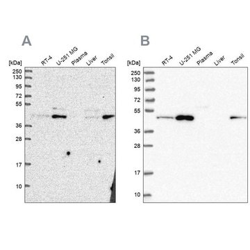 Anti-ZDHHC16 antibody produced in rabbit Prestige Antibodies&#174; Powered by Atlas Antibodies, affinity isolated antibody