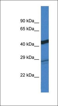 Anti-DGAT2 antibody produced in rabbit affinity isolated antibody