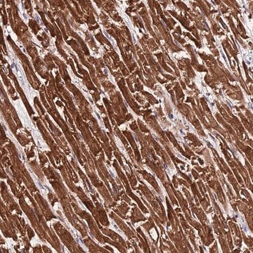 Anti-PDE4D antibody produced in rabbit Prestige Antibodies&#174; Powered by Atlas Antibodies, affinity isolated antibody, buffered aqueous glycerol solution