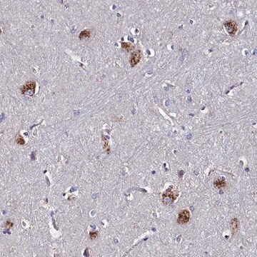 Anti-KIAA1324L antibody produced in rabbit Prestige Antibodies&#174; Powered by Atlas Antibodies, affinity isolated antibody, buffered aqueous glycerol solution