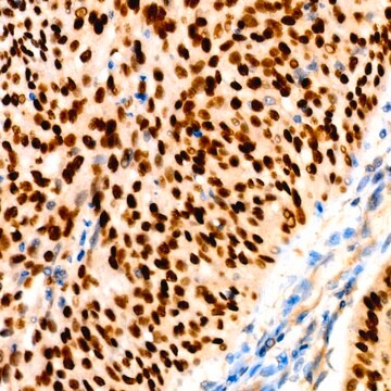 Anti-p63 Antibody, clone 3M9X7, Rabbit Monoclonal