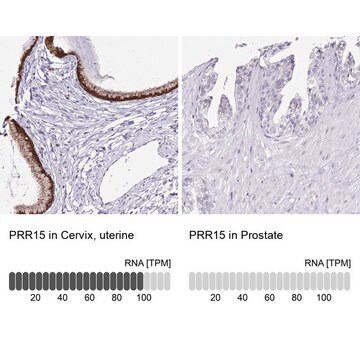 Anti-PRR15 antibody produced in rabbit Prestige Antibodies&#174; Powered by Atlas Antibodies, affinity isolated antibody, buffered aqueous glycerol solution