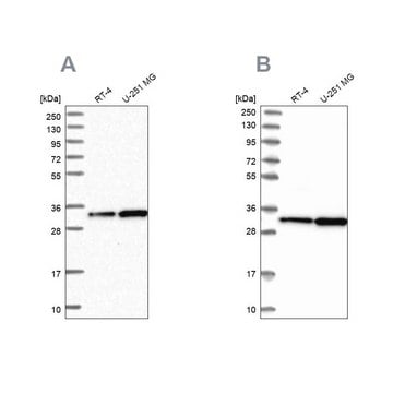 Anti-TBCB antibody produced in rabbit Prestige Antibodies&#174; Powered by Atlas Antibodies, affinity isolated antibody, buffered aqueous glycerol solution