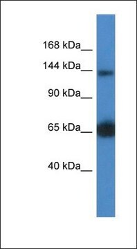 Anti-RAPGEF2 antibody produced in rabbit affinity isolated antibody