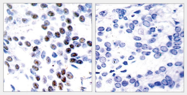 Anti-C-JUN antibody produced in rabbit affinity isolated antibody