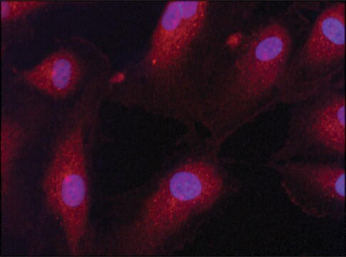 Anti-eIF2B&#946; (N-terminal) antibody produced in rabbit ~1.0&#160;mg/mL, affinity isolated antibody, buffered aqueous solution