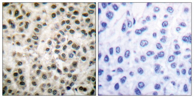 Anti-MEF2A antibody produced in rabbit affinity isolated antibody