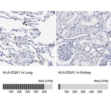 Anti-HLA-DQA1 antibody produced in rabbit Prestige Antibodies&#174; Powered by Atlas Antibodies, affinity isolated antibody, buffered aqueous glycerol solution