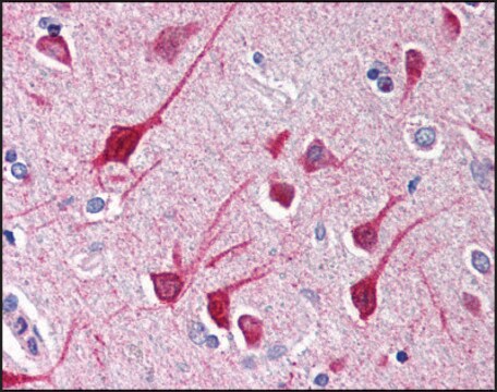 Anti-NLRP1 antibody produced in rabbit IgG fraction of antiserum, buffered aqueous solution