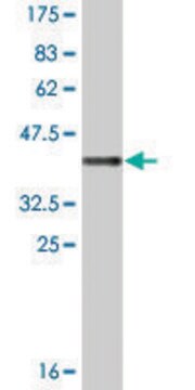 Monoclonal Anti-SPANXB1 antibody produced in mouse clone 2E12, ascites fluid