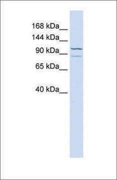 Anti-ADCY6 antibody produced in rabbit affinity isolated antibody