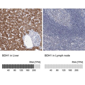 抗-BDH1 兔抗 Prestige Antibodies&#174; Powered by Atlas Antibodies, affinity isolated antibody, buffered aqueous glycerol solution