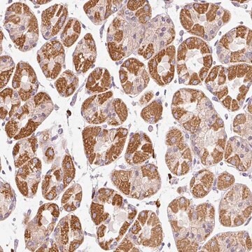 Anti-PNPLA5 antibody produced in rabbit Prestige Antibodies&#174; Powered by Atlas Antibodies, affinity isolated antibody, buffered aqueous glycerol solution