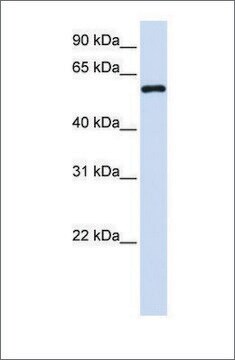 Anti-MTX1 antibody produced in rabbit affinity isolated antibody