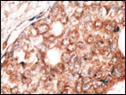 Anti-Hippocalcin (N-term) antibody produced in rabbit IgG fraction of antiserum, buffered aqueous solution