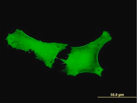 Anti-GPATCH2 antibody produced in mouse purified immunoglobulin, buffered aqueous solution