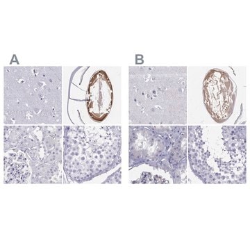 Anti-GJA8 antibody produced in rabbit Prestige Antibodies&#174; Powered by Atlas Antibodies, affinity isolated antibody