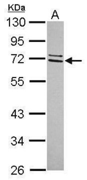 Anti-CCDC67 antibody produced in rabbit affinity isolated antibody, buffered aqueous solution