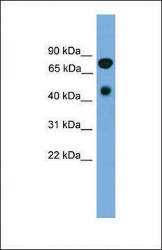 Anti-RIPK4, (N-terminal) antibody produced in rabbit affinity isolated antibody