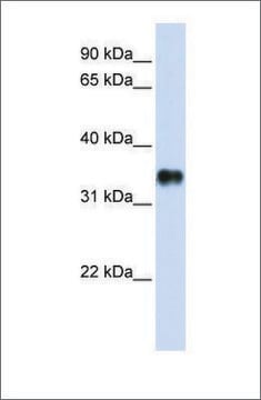 Anti-KCTD7 antibody produced in rabbit affinity isolated antibody