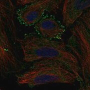 Anti-MC5R antibody produced in rabbit Prestige Antibodies&#174; Powered by Atlas Antibodies, affinity isolated antibody, buffered aqueous glycerol solution