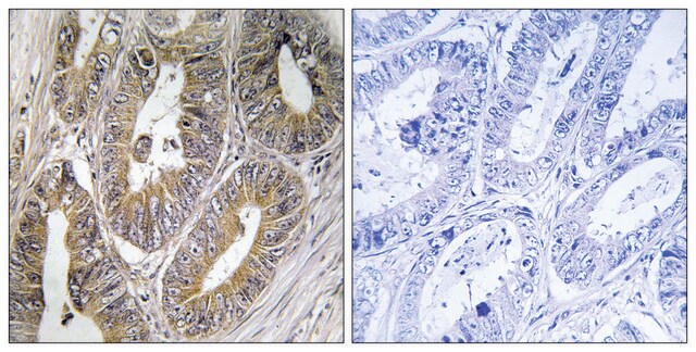 Anti-CST2 antibody produced in rabbit affinity isolated antibody