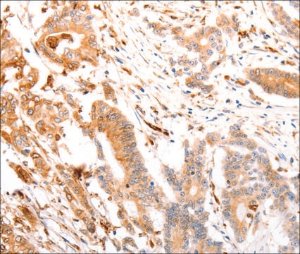 Anti-ABCA4 antibody produced in rabbit affinity isolated antibody