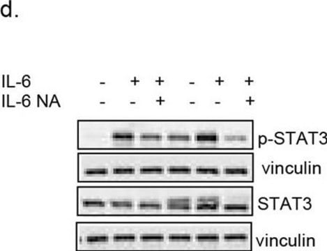 Anti-Vinculin-Antikörper, Klon V284 clone V284, Upstate&#174;, from mouse