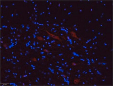 Anti-Purinergic Receptor P2X5 antibody produced in rabbit affinity isolated antibody, lyophilized powder