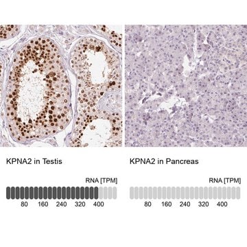 Anti-KPNA2 antibody produced in rabbit Prestige Antibodies&#174; Powered by Atlas Antibodies, affinity isolated antibody, buffered aqueous glycerol solution