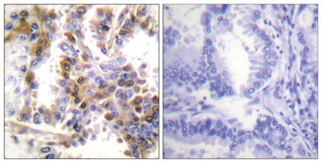 Anti-4E-BP1 antibody produced in rabbit affinity isolated antibody