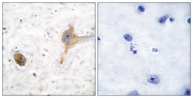 Anti-GABA-B Receptor antibody produced in rabbit affinity isolated antibody