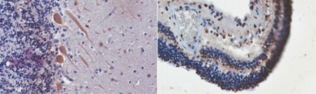 Anti-CaBP1 Antibody, clone 11E7.1 clone 11E7.1, from mouse