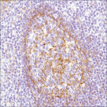 Anti-B7-H3/CD276 antibody, Rabbit monoclonal recombinant, expressed in proprietary host, clone SP206, affinity isolated antibody